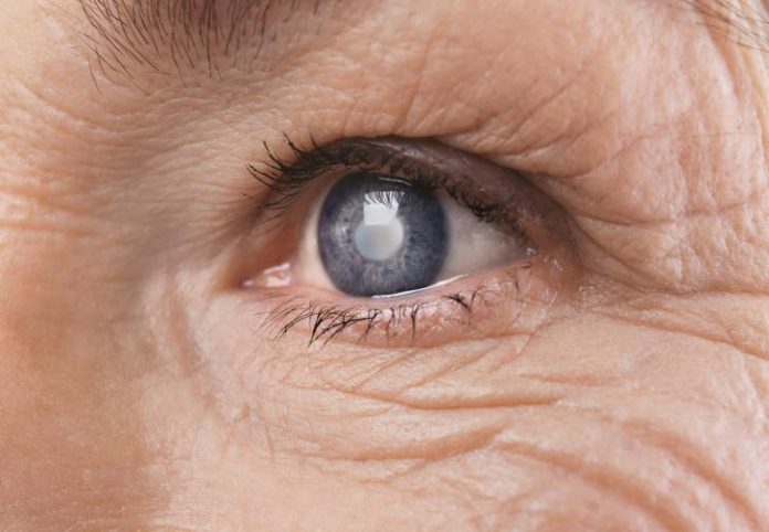 Responsibilities to doctors and hospital for cataracts