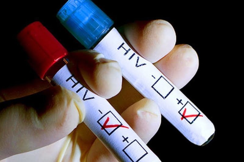 148 διαγνoσεις HIV λο Ιμωξης στην Κyπρο το 2021. Η δΕσμευση Χ ατζηπαντeλα με αφορμor την Παγκo&sigma ;μια Ημèρα κατà του AIDS